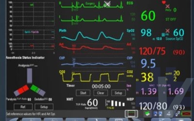 Anestesia e Sedazione